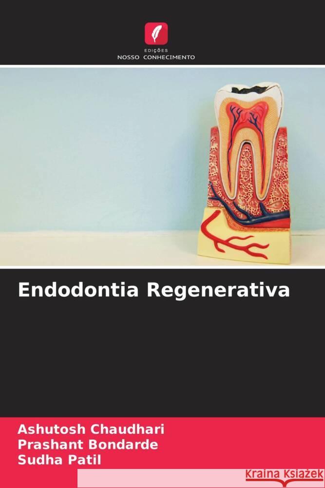 Endodontia Regenerativa Chaudhari, Ashutosh, Bondarde, Prashant, Patil, Sudha 9786204911878