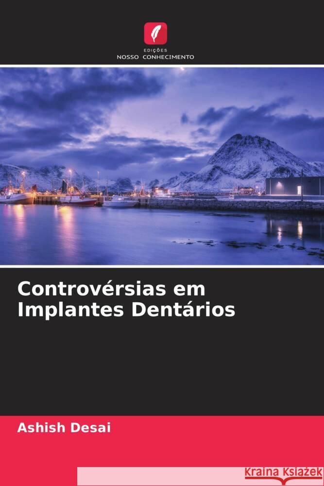 Controvérsias em Implantes Dentários Desai, Ashish 9786204913032