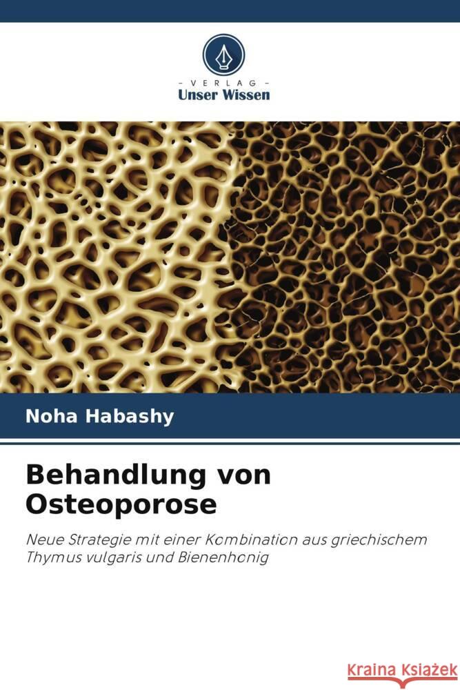 Behandlung von Osteoporose Habashy, Noha 9786204918556 Verlag Unser Wissen