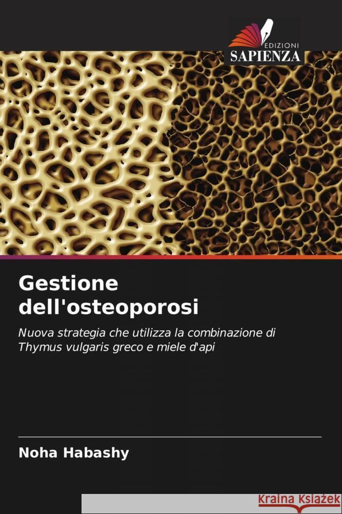 Gestione dell'osteoporosi Habashy, Noha 9786204918594 Edizioni Sapienza