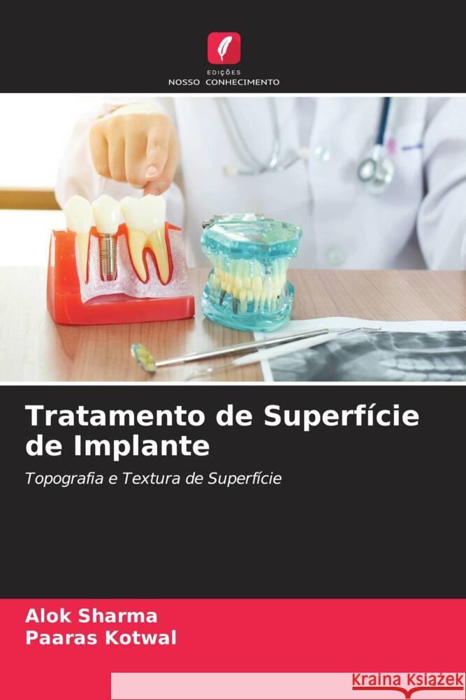 Tratamento de Superfície de Implante Sharma, Alok, Kotwal, Paaras 9786204927022 Edições Nosso Conhecimento