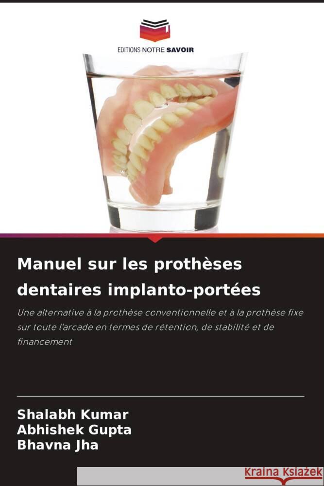 Manuel sur les prothèses dentaires implanto-portées Kumar, Shalabh, Gupta, Abhishek, Jha, Bhavna 9786204930824