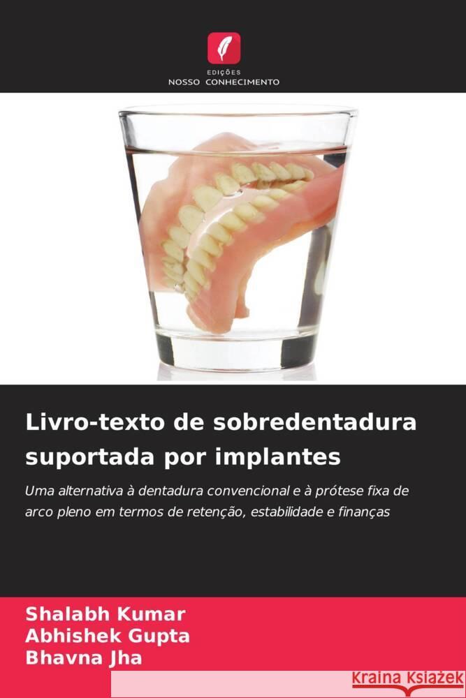 Livro-texto de sobredentadura suportada por implantes Kumar, Shalabh, Gupta, Abhishek, Jha, Bhavna 9786204930954