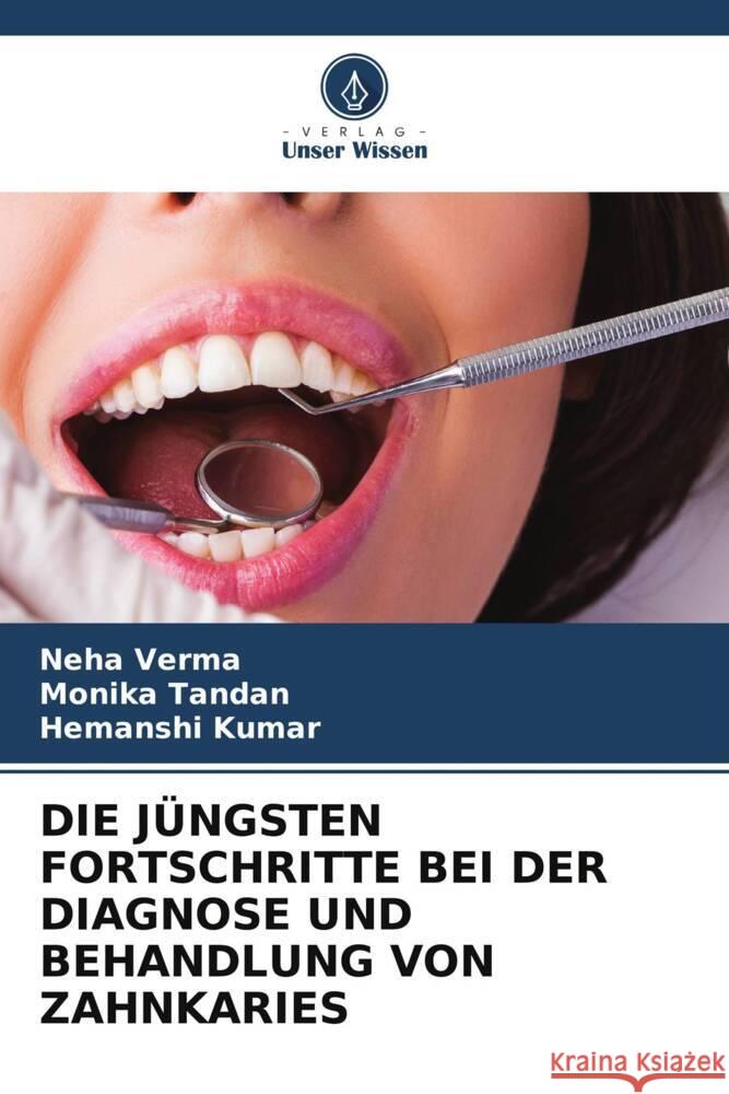 DIE JÜNGSTEN FORTSCHRITTE BEI DER DIAGNOSE UND BEHANDLUNG VON ZAHNKARIES Verma, Neha, Tandan, Monika, Kumar, Hemanshi 9786204932088 Verlag Unser Wissen