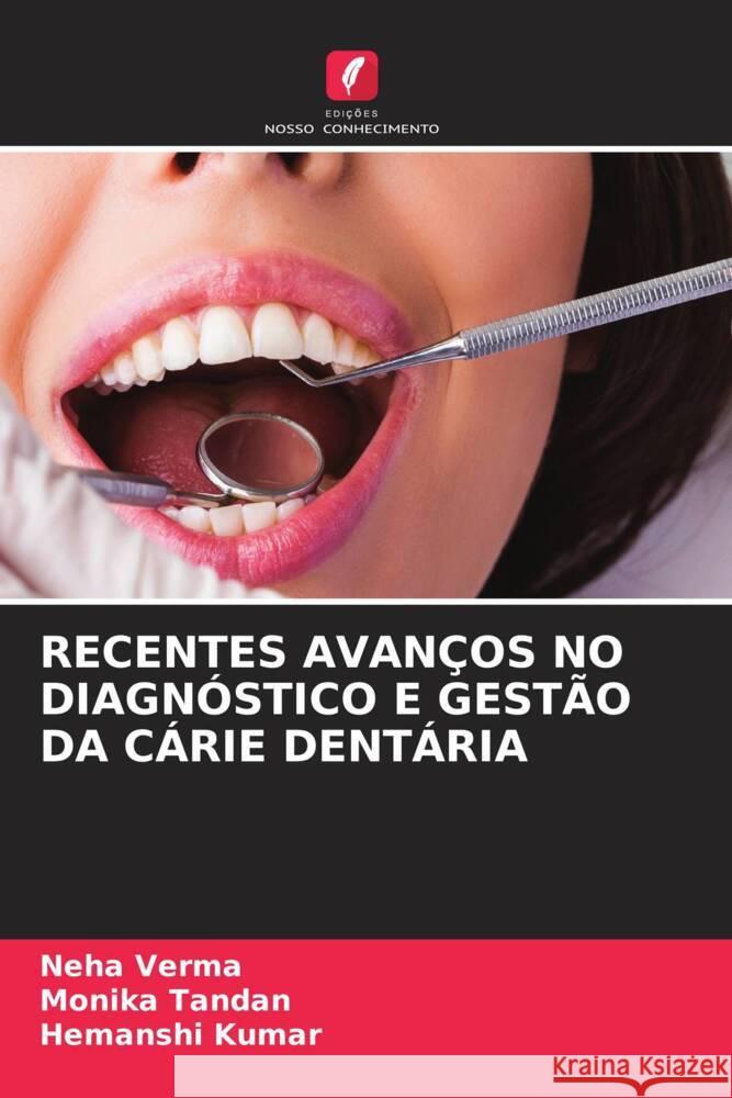 RECENTES AVANÇOS NO DIAGNÓSTICO E GESTÃO DA CÁRIE DENTÁRIA Verma, Neha, Tandan, Monika, Kumar, Hemanshi 9786204932125