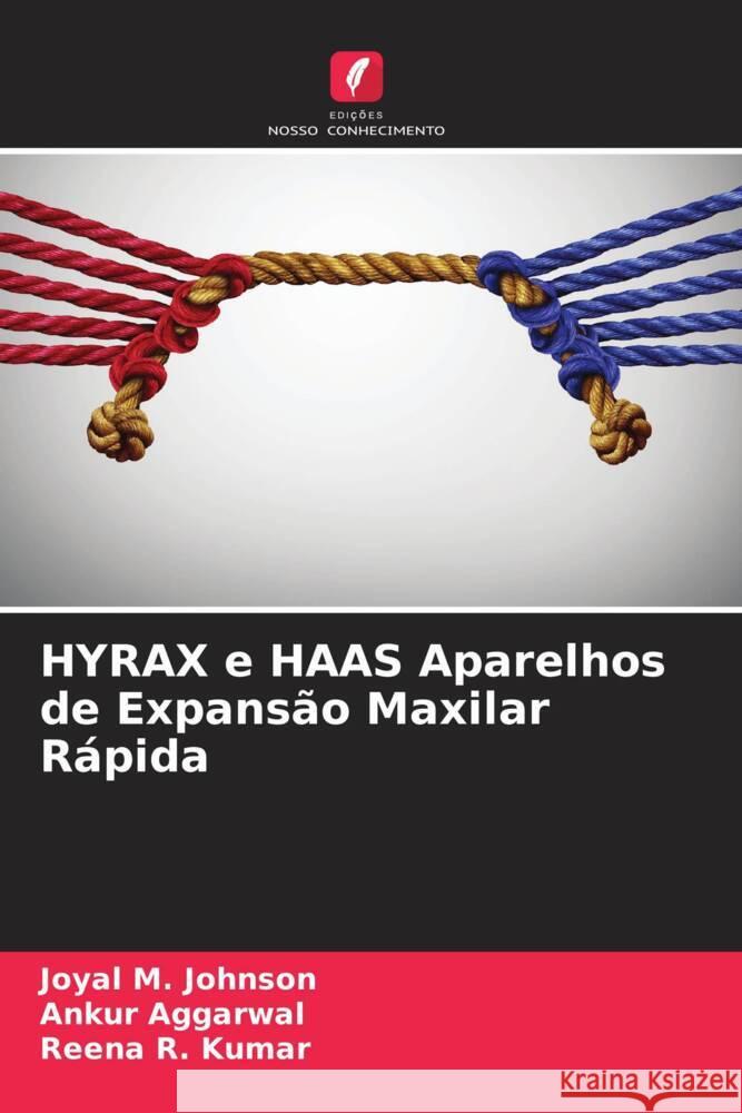 HYRAX e HAAS Aparelhos de Expansão Maxilar Rápida M. Johnson, Joyal, Aggarwal, Ankur, Kumar, Reena R. 9786204947570 Edições Nosso Conhecimento