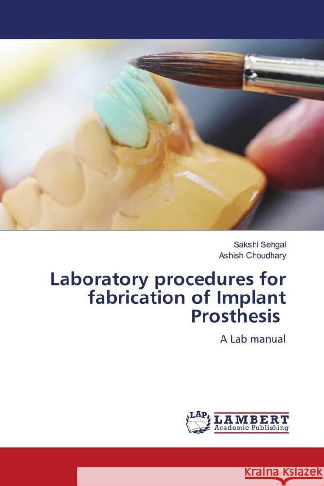 Laboratory procedures for fabrication of Implant Prosthesis Sehgal, Sakshi, Choudhary, Ashish 9786204954462 LAP Lambert Academic Publishing