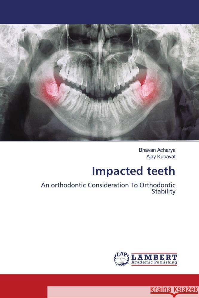 Impacted teeth Acharya, Bhavan, KUBAVAT, AJAY 9786204977966 LAP Lambert Academic Publishing