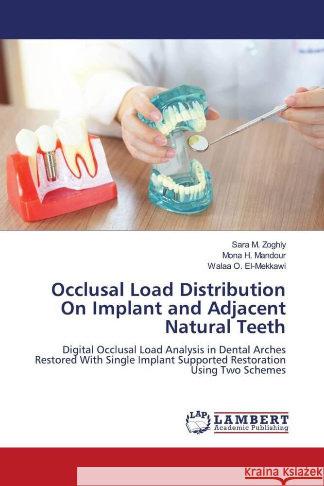 Occlusal Load Distribution On Implant and Adjacent Natural Teeth Zoghly, Sara M., Mandour, Mona H., El-Mekkawi, Walaa O. 9786204979878