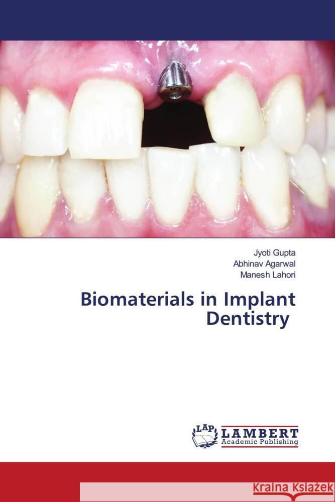 Biomaterials in Implant Dentistry Gupta, Jyoti, Agarwal, Abhinav, Lahori, Manesh 9786204979939