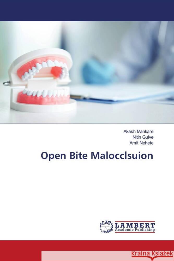 Open Bite Malocclsuion Mankare, Akash, Gulve, Nitin, Nehete, Amit 9786204982557 LAP Lambert Academic Publishing