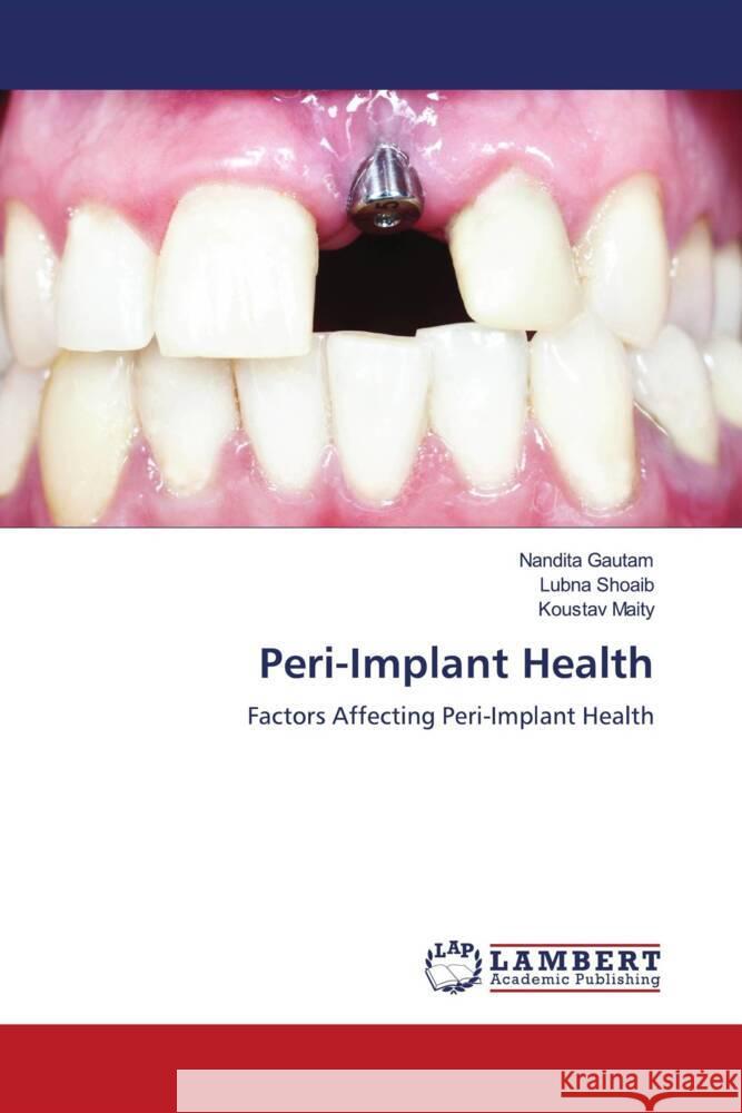 Peri-Implant Health Gautam, Nandita, Shoaib, Lubna, Maity, Koustav 9786204984537 LAP Lambert Academic Publishing