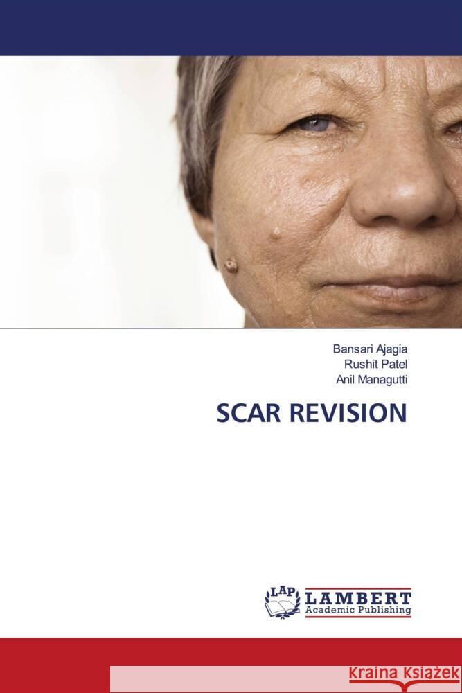 SCAR REVISION Ajagia, Bansari, Patel, Rushit, Managutti, Anil 9786204985114