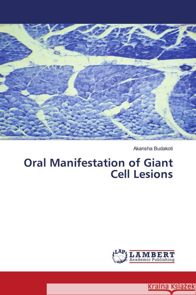 Oral Manifestation of Giant Cell Lesions Budakoti, Akansha 9786204985510