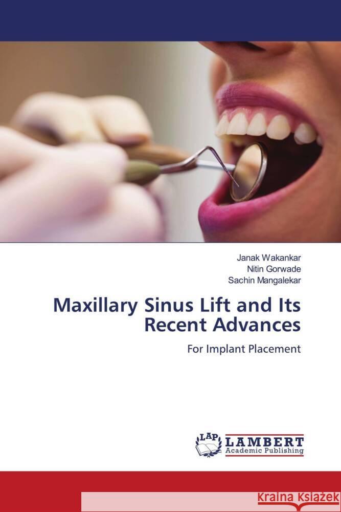 Maxillary Sinus Lift and Its Recent Advances Wakankar, Janak, Gorwade, Nitin, Mangalekar, Sachin 9786204985800 LAP Lambert Academic Publishing