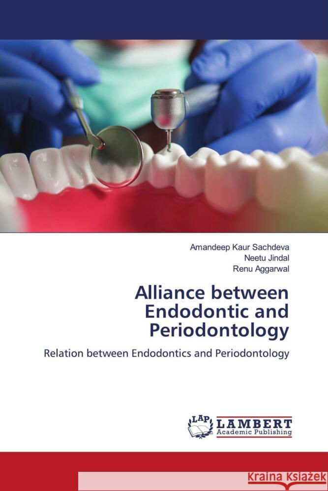 Alliance between Endodontic and Periodontology Sachdeva, Amandeep Kaur, Jindal, Neetu, Aggarwal, Renu 9786204986142 LAP Lambert Academic Publishing