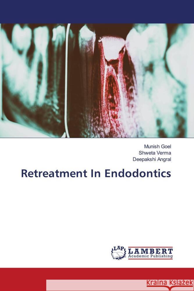 Retreatment In Endodontics Goel, Munish, Verma, Shweta, Angral, Deepakshi 9786204986463 LAP Lambert Academic Publishing