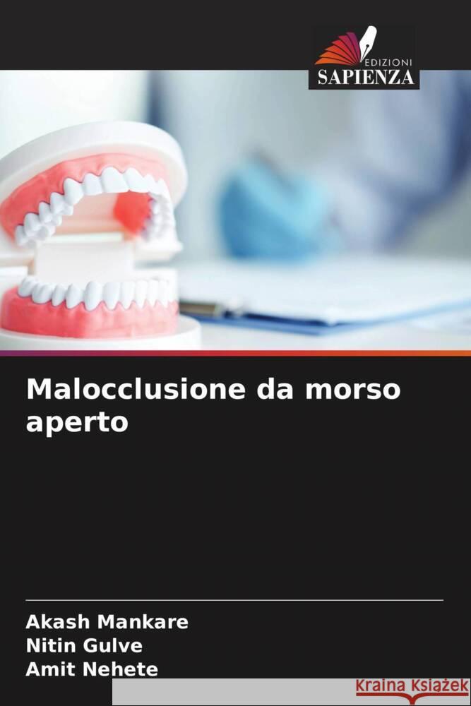 Malocclusione da morso aperto Mankare, Akash, Gulve, Nitin, Nehete, Amit 9786205002476