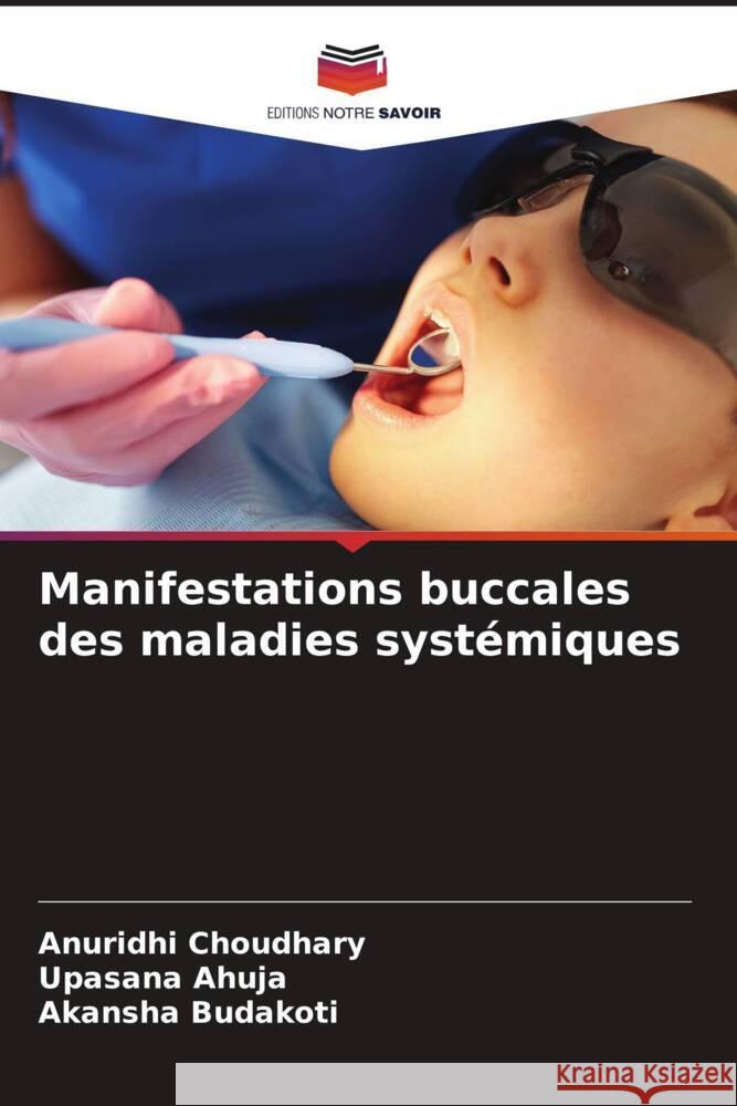 Manifestations buccales des maladies systémiques Choudhary, Anuridhi, Ahuja, Upasana, Budakoti, Akansha 9786205008362 Editions Notre Savoir