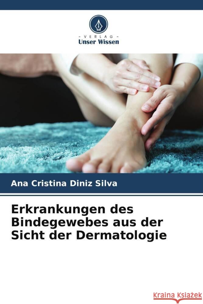 Erkrankungen des Bindegewebes aus der Sicht der Dermatologie Diniz Silva, Ana Cristina 9786205008454