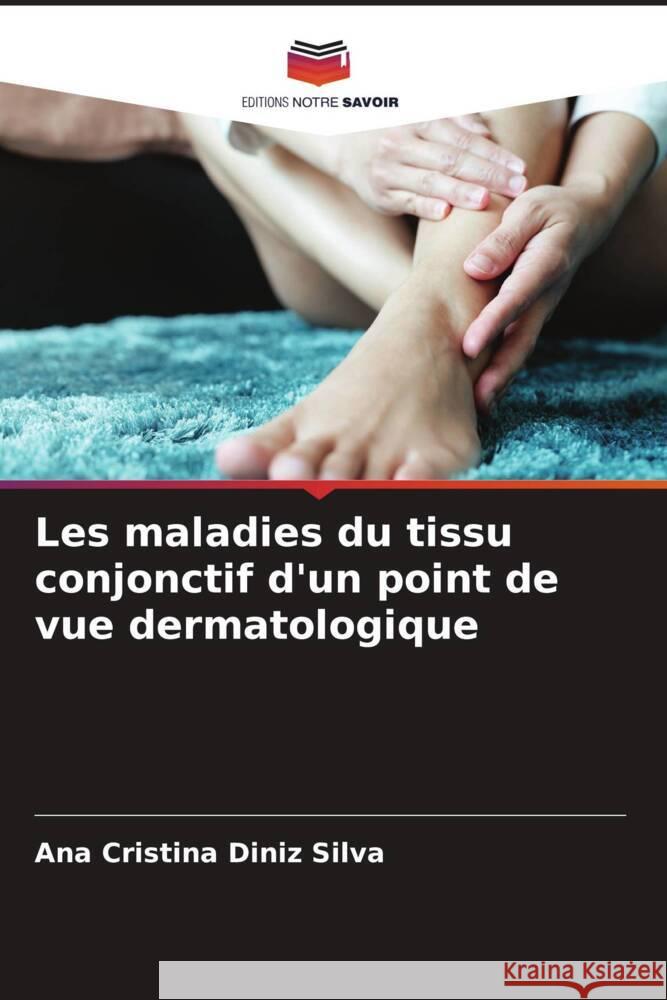 Les maladies du tissu conjonctif d'un point de vue dermatologique Diniz Silva, Ana Cristina 9786205008478