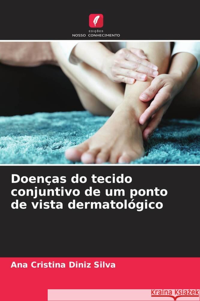 Doenças do tecido conjuntivo de um ponto de vista dermatológico Diniz Silva, Ana Cristina 9786205008492