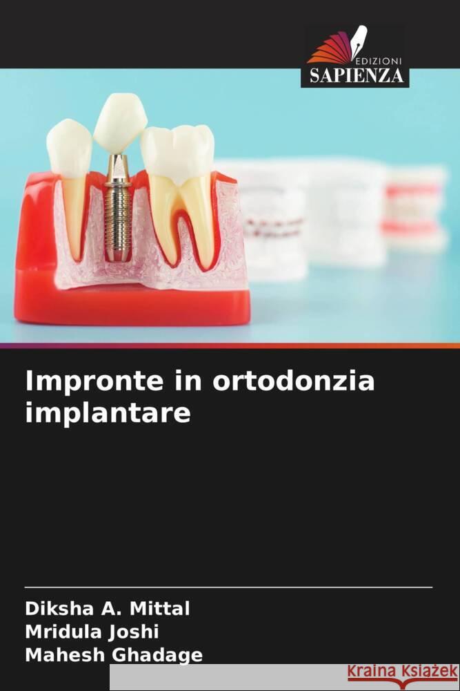 Impronte in ortodonzia implantare A. Mittal, Diksha, Joshi, Mridula, Ghadage, Mahesh 9786205022733
