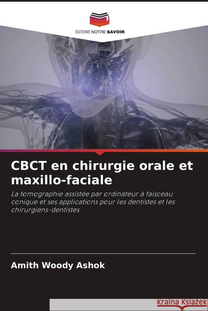 CBCT en chirurgie orale et maxillo-faciale Woody Ashok, Amith 9786205025512