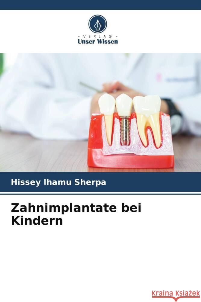 Zahnimplantate bei Kindern lhamu Sherpa, Hissey 9786205039656