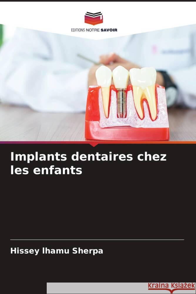 Implants dentaires chez les enfants lhamu Sherpa, Hissey 9786205039670