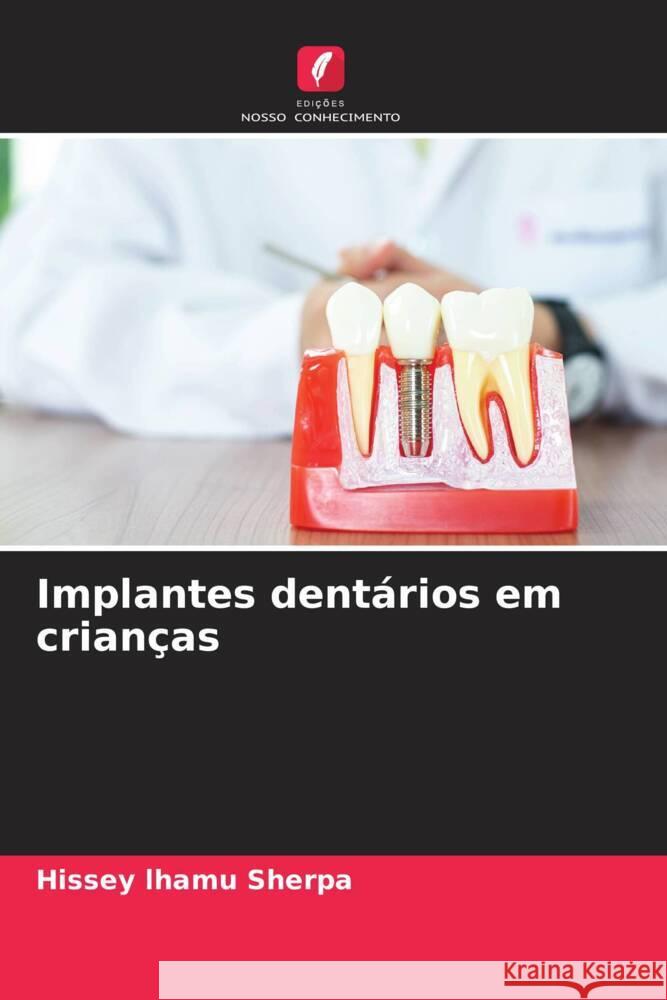 Implantes dentários em crianças lhamu Sherpa, Hissey 9786205039694