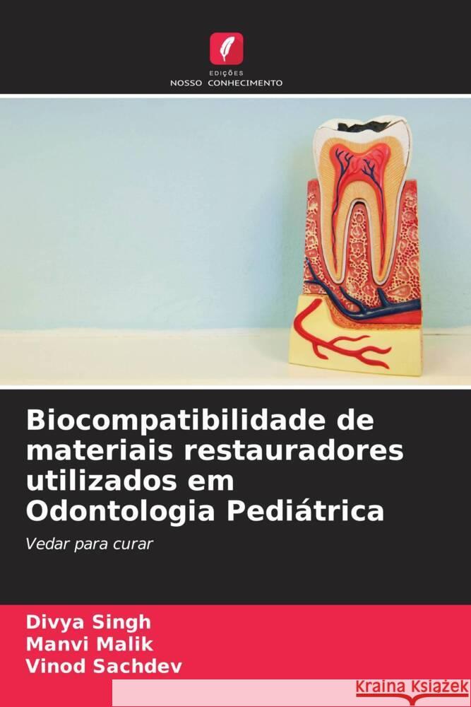 Biocompatibilidade de materiais restauradores utilizados em Odontologia Pediátrica Singh, Divya, Malik, Manvi, Sachdev, Vinod 9786205041420 Edições Nosso Conhecimento