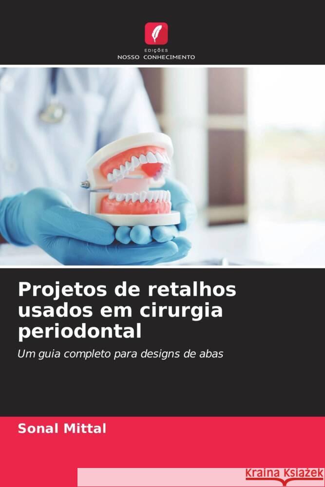 Projetos de retalhos usados   em cirurgia periodontal Mittal, Sonal 9786205043868