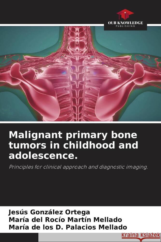 Malignant primary bone tumors in childhood and adolescence. González Ortega, Jesús, Martín Mellado, María del Rocío, Palacios Mellado, María de los D. 9786205043929