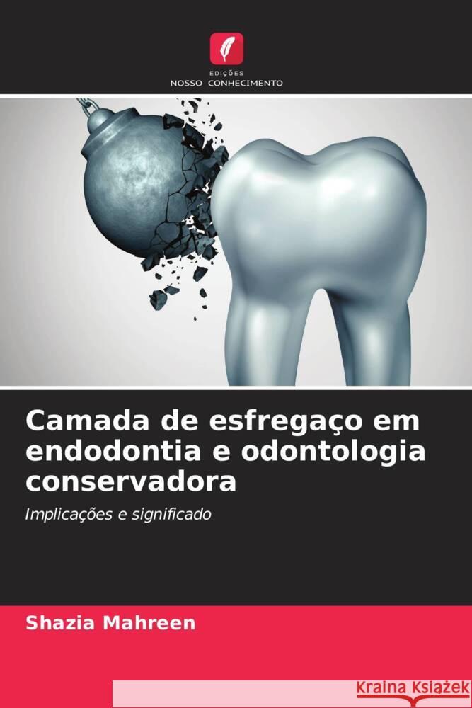 Camada de esfregaço em endodontia e odontologia conservadora MAHREEN, SHAZIA 9786205046296