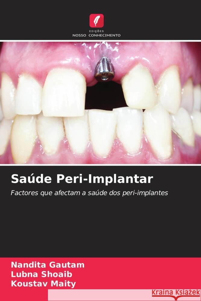 Saúde Peri-Implantar Gautam, Nandita, Shoaib, Lubna, Maity, Koustav 9786205051580 Edições Nosso Conhecimento