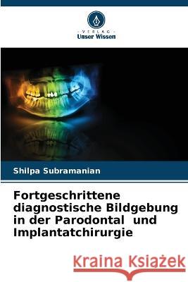 Fortgeschrittene diagnostische Bildgebung in der Parodontal und Implantatchirurgie Shilpa Subramanian   9786205056714 Verlag Unser Wissen