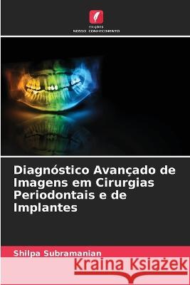 Diagnostico Avancado de Imagens em Cirurgias Periodontais e de Implantes Shilpa Subramanian   9786205056752 Edicoes Nosso Conhecimento