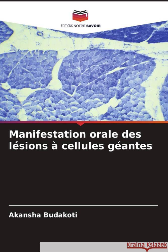 Manifestation orale des lésions à cellules géantes Budakoti, Akansha 9786205059814