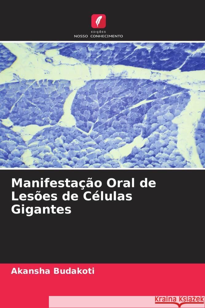 Manifestação Oral de Lesões de Células Gigantes Budakoti, Akansha 9786205059838