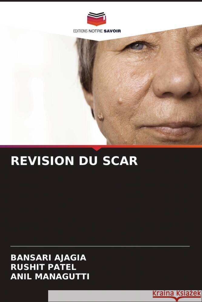 REVISION DU SCAR Ajagia, Bansari, Patel, Rushit, Managutti, Anil 9786205071991 Editions Notre Savoir