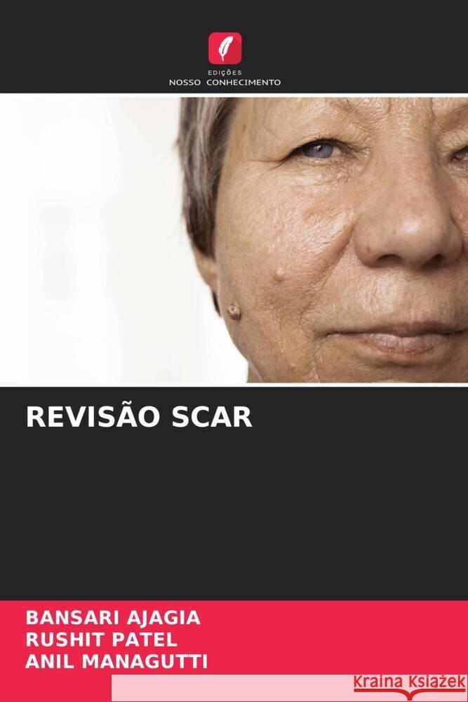 REVISÃO SCAR Ajagia, Bansari, Patel, Rushit, Managutti, Anil 9786205072011 Edições Nosso Conhecimento