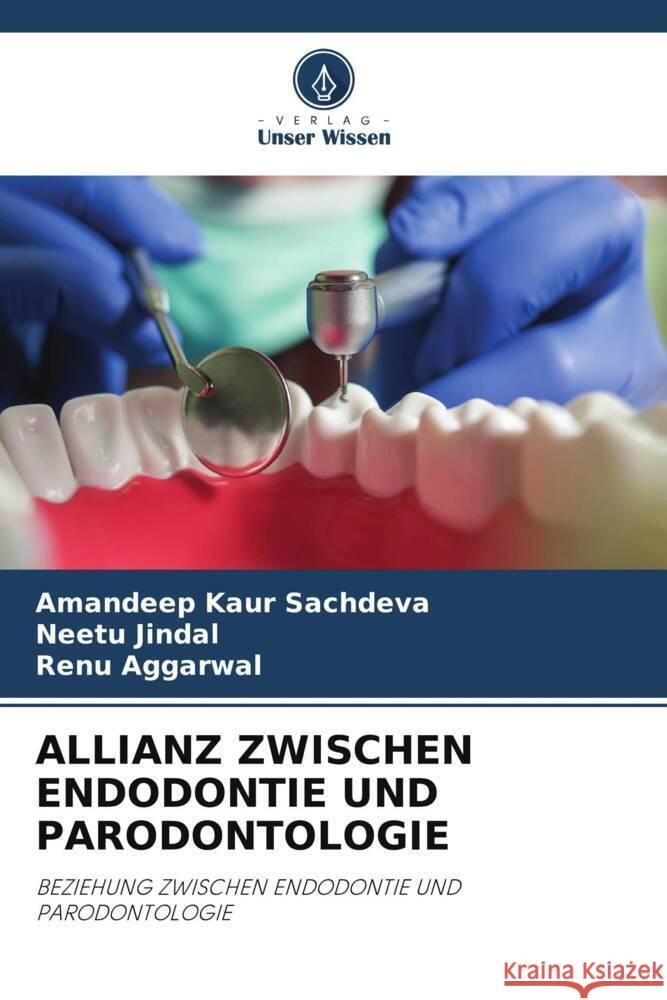 ALLIANZ ZWISCHEN ENDODONTIE UND PARODONTOLOGIE Sachdeva, Amandeep Kaur, Jindal, Neetu, Aggarwal, Renu 9786205073094 Verlag Unser Wissen