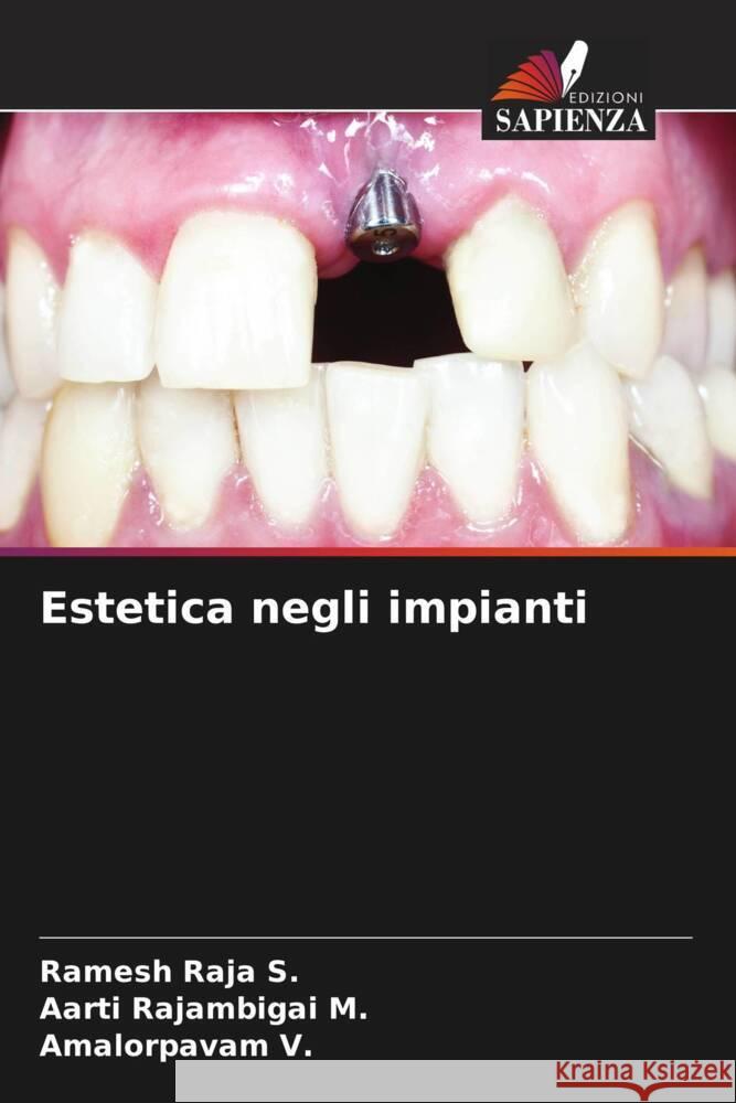 Estetica negli impianti Raja S., Ramesh, Rajambigai M., Aarti, V., Amalorpavam 9786205073902 Edizioni Sapienza