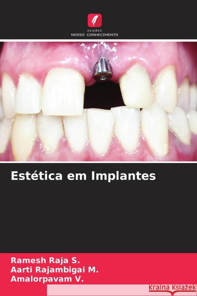 Estética em Implantes Raja S., Ramesh, Rajambigai M., Aarti, V., Amalorpavam 9786205073919 Edições Nosso Conhecimento