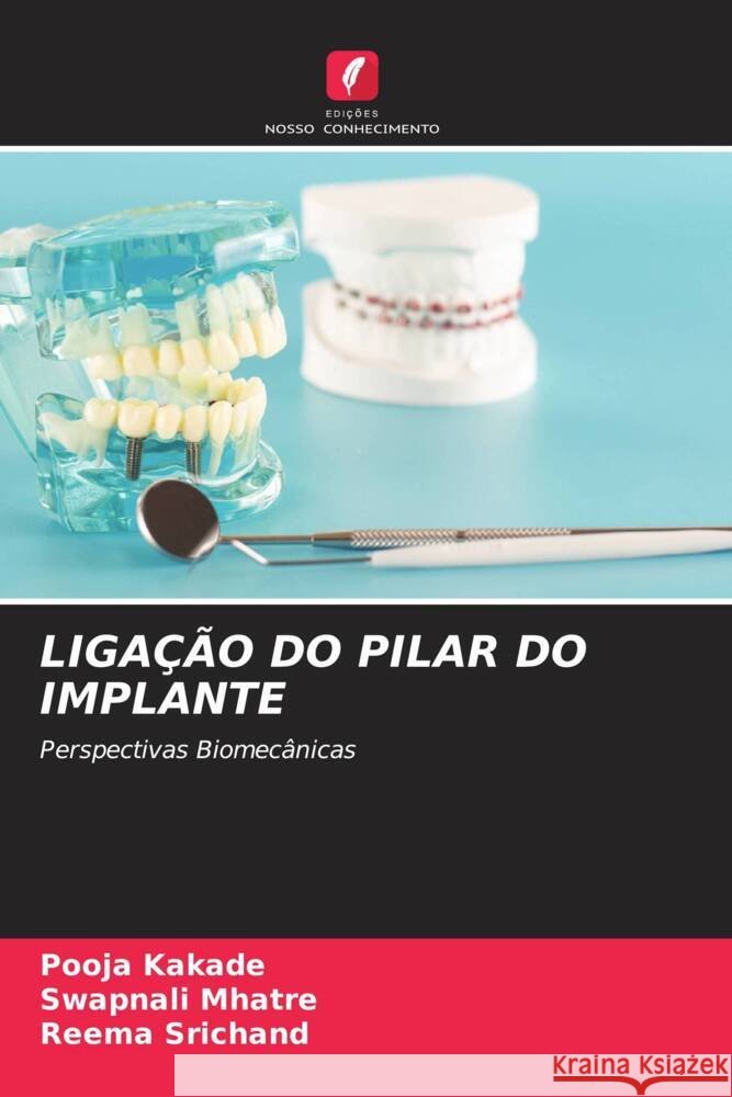 LIGAÇÃO DO PILAR DO IMPLANTE Kakade, Pooja, Mhatre, Swapnali, Srichand, Reema 9786205075166