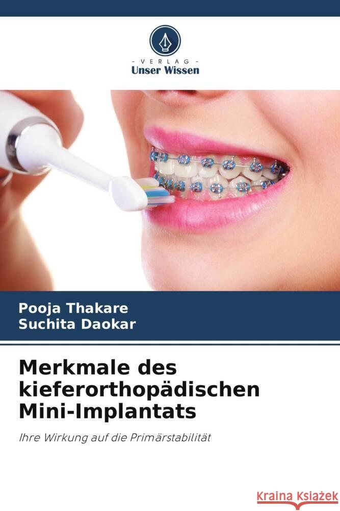 Merkmale des kieferorthopädischen Mini-Implantats Thakare, Pooja, Daokar, Suchita 9786205077078