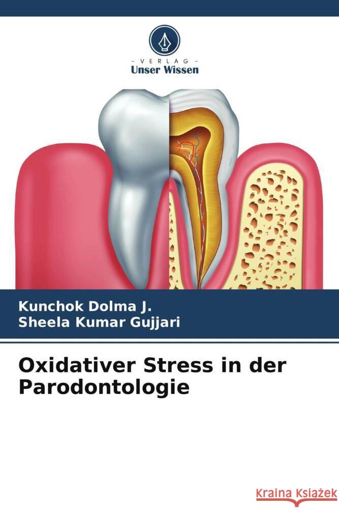 Oxidativer Stress in der Parodontologie Dolma J., Kunchok, Gujjari, Sheela kumar 9786205080870