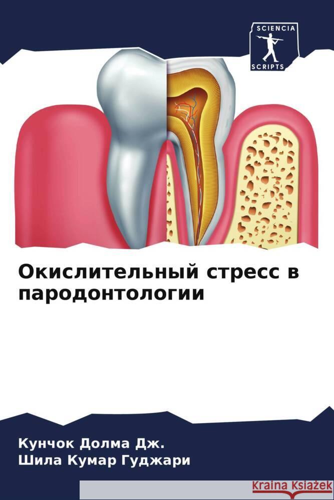 Okislitel'nyj stress w parodontologii Dolma Dzh., Kunchok, Gudzhari, Shila Kumar 9786205080900