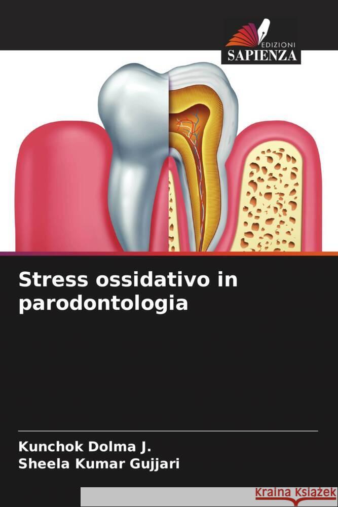 Stress ossidativo in parodontologia Dolma J., Kunchok, Gujjari, Sheela kumar 9786205080917